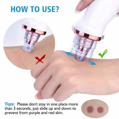 Rechargeable Vacuum Pore Cleaner, 5 In 1 Blackheads Removing Device Electric Derma suction Machine | USB Rechargeable Acne Pimple Pore Cleaner Vacuum tool - Facial Cleanser Device for Nose & Skin Care